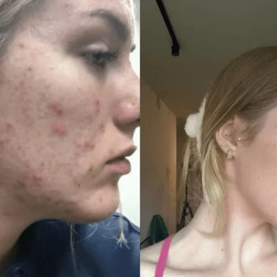 Resultado antes y después Cellstory 7